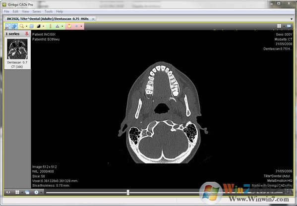 DICOM瀏覽器_Ginkgo CADx Pro(dicom看圖軟件)綠色版